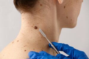 spot removal in Alexandria