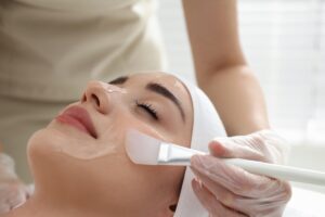 chemical-peel-treatment-in-Alexandria