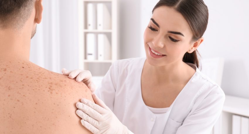 Eczema-Treatment-in-Alexandria