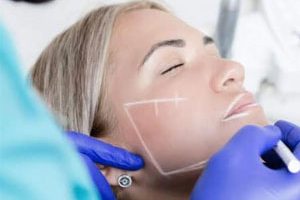 Mohs-Micrographic-Surgery