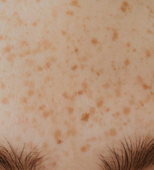 Sun Spots