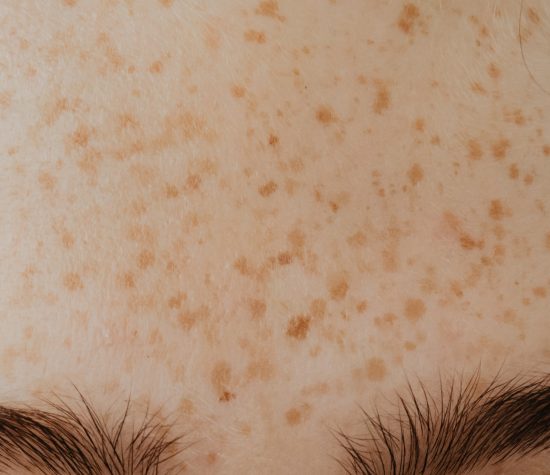 Sun Spots