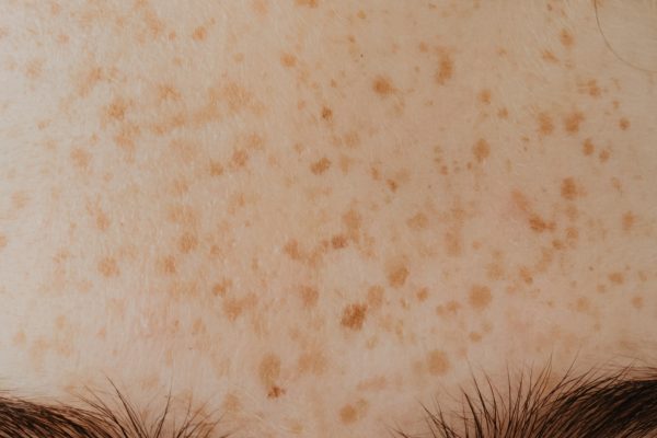 Sun Spots