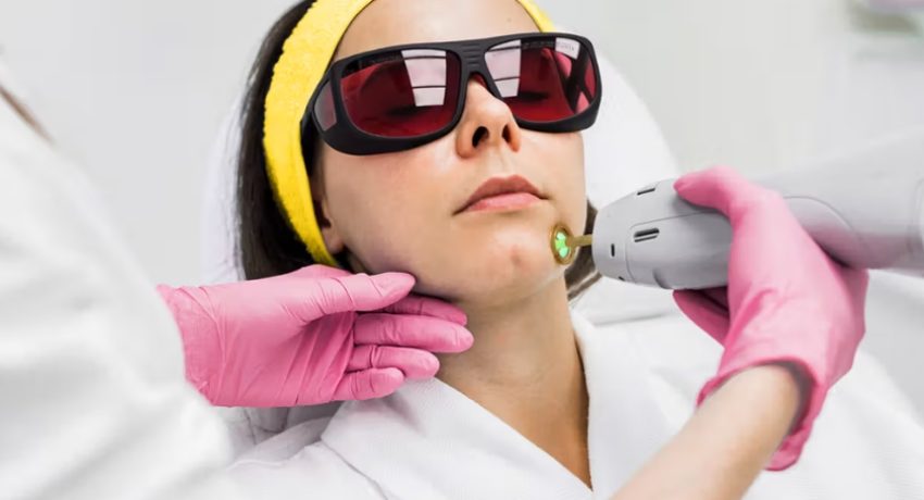 The Complete Guide to Laser Hair Removal All the Information You Need