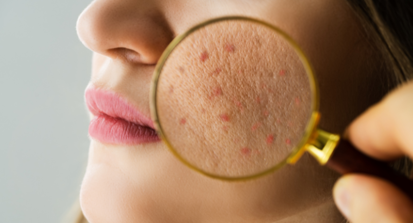 dermatologist alexandria