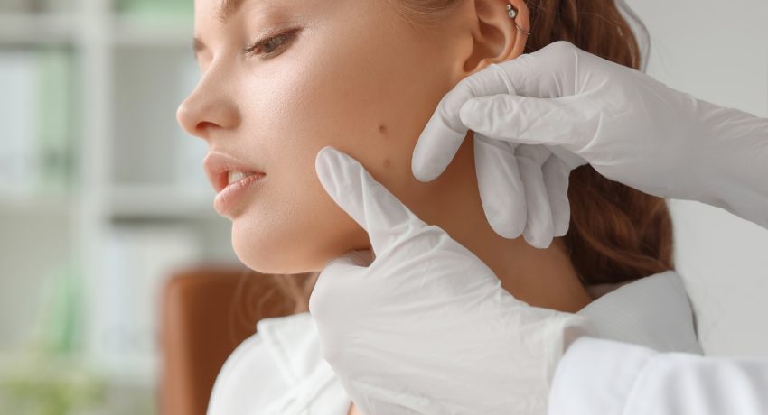 dermatologist-in-Alexandria