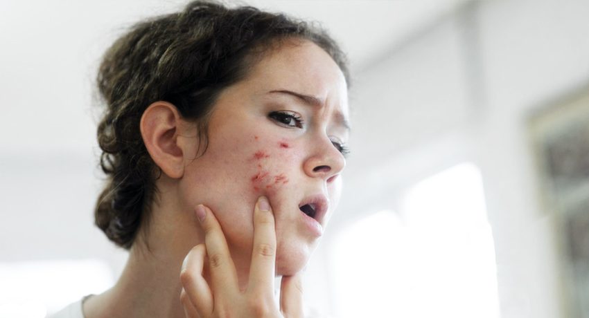 img-reasons-you-should-see-a-dermatologist