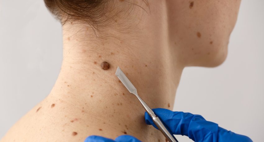 spot removal in Alexandria